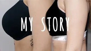 MY BIG REDUCTION STORY | Full recovery included