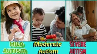 LEVEL OF AUTISM (MILD , MODERATE , SEVERE),cure virtual autism