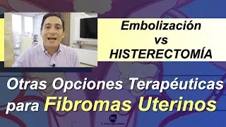 EMBOLIZACIÓN DE LA ARTERIA UTERINA Y TRATAMIENTO MEDICO DE FIBROMAS UTERINOS VS HISTERECTOMIA