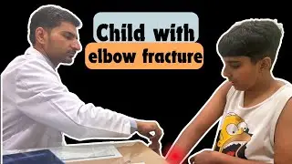 Elbow Fracture While Playing