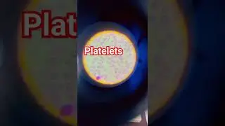Microscope| platelets DLC  #platelets #cbc #shorts #youtubeshorts