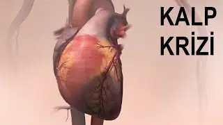 Kalp Krizi Nasıl Gerçekleşir? [Kısa Versiyon]