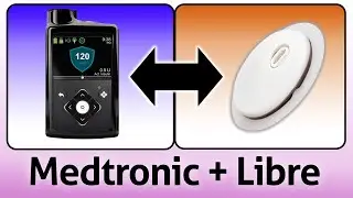 Medtronic's New CGM Powered by Libre - Explained