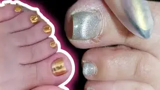 педикюр ПРИБИЛА НОГОТЬ#НОГТИ#педикюр#сложные#аленалаврентьева