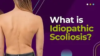 What is Idiopathic Scoliosis?