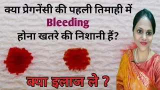 Bleeding in Early Pregnancy Causes and Treatment | Pregnancy me Bleeding kyu Hoti Hai |Is it normal?