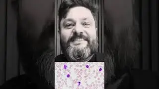 Linfocito anómalo - o que é