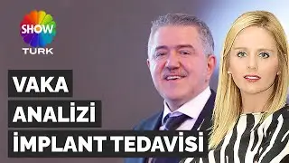 VAKA ANALİZİ: LAZERLE İMPLANT TEDAVİSİ | HAREKETLİ PROTEZ | SHOWTURK, EYLEM AKSIN & ZAFER KAZAK