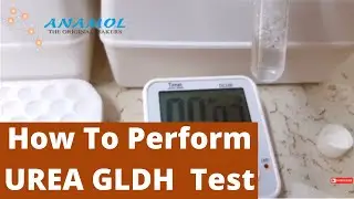 Urea Test Procedure | Urea UV Test