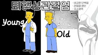 퇴행성관절염6 - 세포외기질, 관절염원인, 국소영역