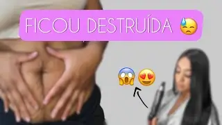 MINHA BARRIGA APÓS SEGUNDA GESTAÇÃO | NOVO TRATAMENTO PARA ESTRIAS !!! ✨🙌🏼