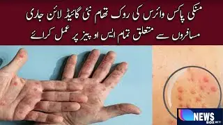 Prevention of monkeypox virus new guideline released