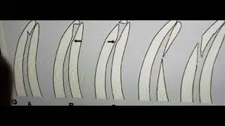 What are the common errors in root canal preparation?