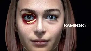 3D animation: female upper and lower blepharoplasty ⭕️ KAMINSKYI