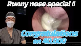 Runny nose special : 40,000 subscriber congrats!! (4만구독자 미리축하영상)