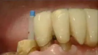 Video_C&Post_eng1.wmv