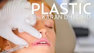 Lip Injections with Filler (Bow and Arrow Technique) | PLASTIC with Dr. Dhir