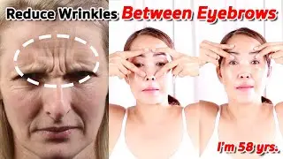 Reduce wrinkles between eyebrows | NO TALKING | Facial Massage