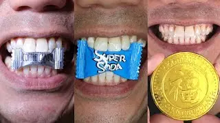 Doctor Tristan Peh Chewing ASMR Trending on YouTube