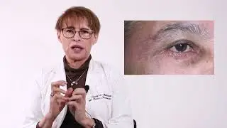 Reconstrucción facial por cáncer de piel - Dra. Jezabel de Abullarade