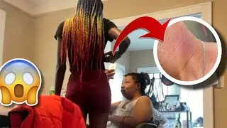 Hickey prank on my mother…idk exactly how that went😂🤷🏾‍♀️ (FIRST PRANK)