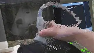 AR Echography: Volumetric Video Navigation of Diagnostic Image Acquisition