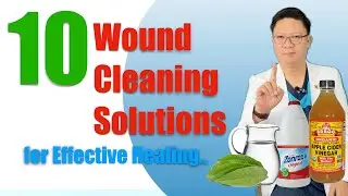 10 MABISANG PANGLINIS SA SUGAT NA DAPAT MONG MALAMAN #woundcare #woundhealing