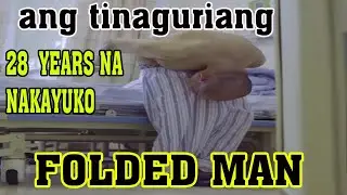 🇵🇭 Ang Taong Nakayuko ng 28 Years| Tinaguriang Folded Man