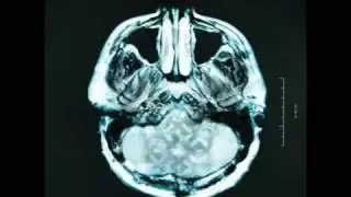 Breaking Benjamin -  I Will Not Bow