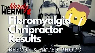 Results of chiropractics for Fibromyalgia..