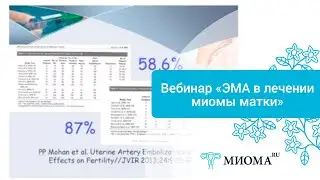 Первый вебинар по лечению миомы матки с использованием эмболизации маточных артерий