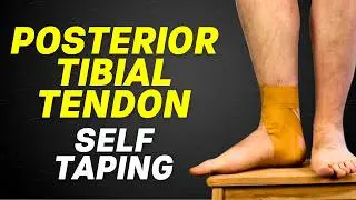 Posterior Tibial Tendonitis Taping | Posterior Tibial Tendon Dysfunction Taping