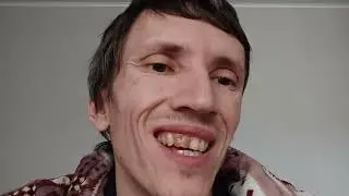 Сходил к стоматологу