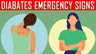 Decoding Diabetes: 10 Surprising Skin Signals You Shouldn't Ignore!