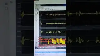 Direct Torque Control of a PMSM in MATLAB SIMULINK - DTC PMSM - DTC - PMSM - Torque control