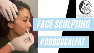 Face Sculpting | Dr. Benjamin Caughlin Facial Contouring Procedures #facesculpting #facecontouring