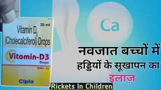 Vitamin D3 Drop - Cholecalciferol 400/800 Units Drop / Explain By DRX-HASAN ANSARI