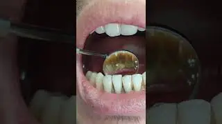 💥💥💥😱 РУЗА ТУТДИМ , ОFЗИМДАН ЁМОН ХИД КЕЛСА НИМА КИЛАЙ,САБАБЛАРИ НИМА⁉️💥💥👍👍
