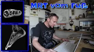 MRT vom Fuß