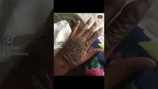 Be careful with temporary tattoos done on beaches and sunny places