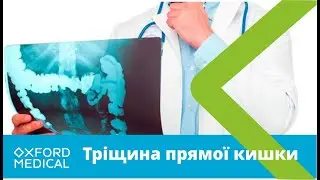 Тріщина прямої кишки. ПРИЧИНИ. СИМПТОМИ анальної тріщини.
