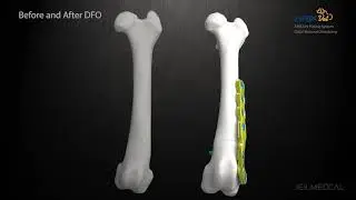 [ARIX Vet] DFO Surgical Guide Animation