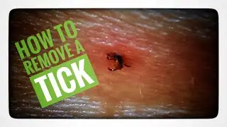 Fisherman Aki ~ How To Remove A Tick #nature #tick #animals #bags #howto