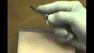 02   Scalpel Holding