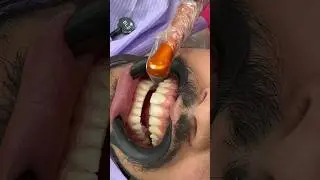 VÍDEO COMPLETO NO INSTAGRAM: @oclandesttino
