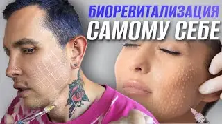 БИОРЕВИТАЛИЗАЦИЯ самому себе | Как я делаю себе инъекции 