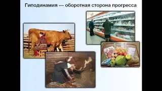 Гиподинамия