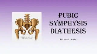 Pubic symphysis diathesis - causes, imaging findings, treatment