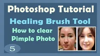 Healing Brush Tools | Clear Pimple Photo in Photoshop | Photoshop Tutorial CS3