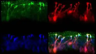 Three-dimensionally reconstructed images of immunostaining of the mouse ear epidermal sheet (Part 2)